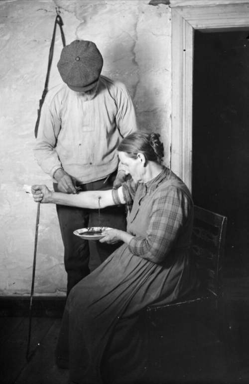 Эта фотография была сделана этнологом Нильсом Кейландом в приходе Мангског, Вермланд, Швеция, в 1922 году. Мужчина держит в руках инструмент для кровопускания, известный как блоха.